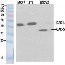 Anti-ICAD antibody