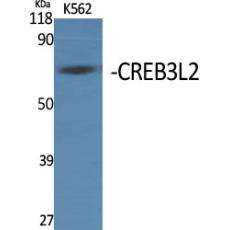 Anti-CREB3L2 antibody