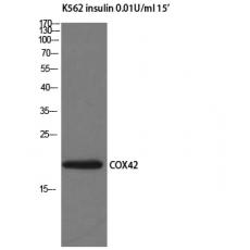 Anti-COX4I2 antibody