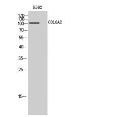 Anti-COL6A2 antibody