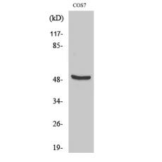 Anti-DP-2 antibody