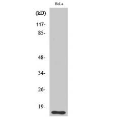 Anti-DOC-1 antibody