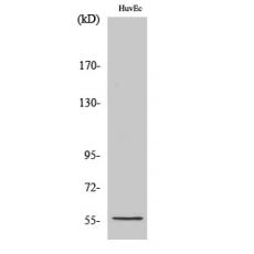 Anti-CYP2S1 antibody