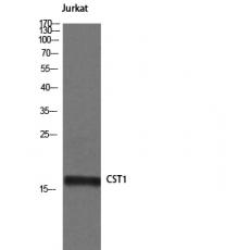 Anti-Cystatin SN antibody