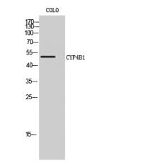 Anti-CYP4B1 antibody