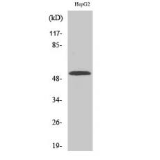 Anti-CYP2W1 antibody