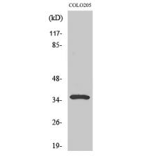 Anti-GIMAP5 antibody