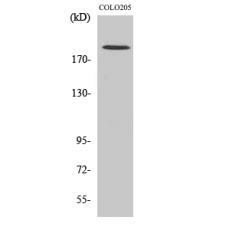 Anti-GCP6 antibody