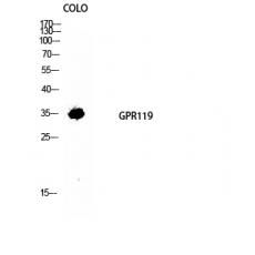 Anti-GPR119 antibody