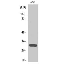 Anti-Inhibin β-C antibody