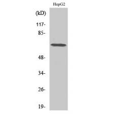 Anti-DDX52 antibody