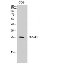 Anti-GPR40 antibody