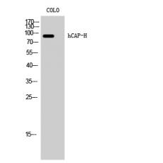 Anti-hCAP-H antibody