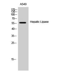 Anti-Hepatic Lipase antibody