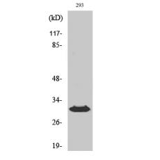 Anti-HLA-DOβ antibody