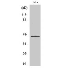 Anti-HORMAD1 antibody