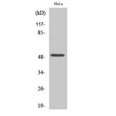 Anti-Egr-2 antibody