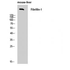 Anti-FBN1 antibody