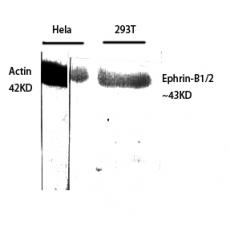 Anti-Ephrin-B1/2 antibody