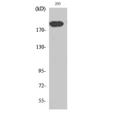 Anti-Endo180 antibody