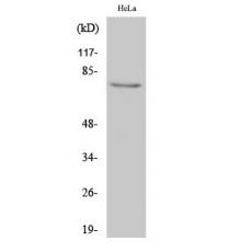 Anti-IRAK-1 antibody