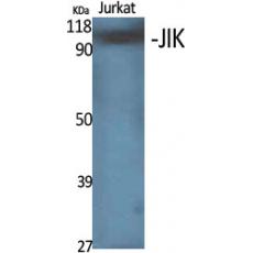 Anti-JIK antibody