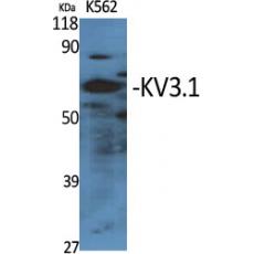 Anti-KV3.1 antibody