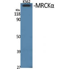 Anti-MRCKα antibody