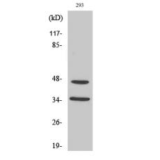 Anti-FoxB1/2 antibody