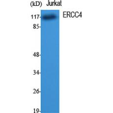 Anti-ERCC4 antibody