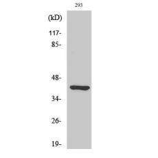 Anti-Ethanolamine kinase 2 antibody