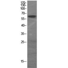 Anti-GAD-65/67 antibody