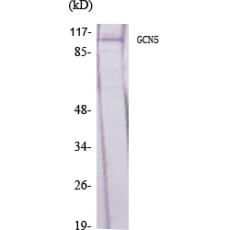 Anti-GCN5 antibody