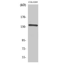 Anti-NFATc4 antibody