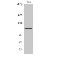 Anti-NFATc3 antibody