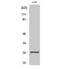 Anti-NET-5 antibody