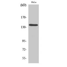 Anti-DDX8 antibody