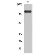 Anti-Dio-1 antibody