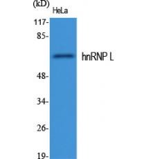 Anti-hnRNP L antibody