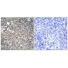 Anti-MAST205 antibody