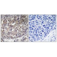 Anti-MDA5 antibody