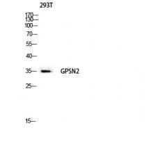 Anti-GPSN2 antibody