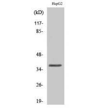 Anti-Hel-N1 antibody