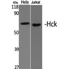 Anti-Hck antibody