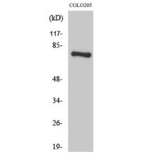 Anti-HLX1 antibody