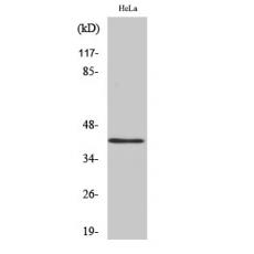 Anti-hnRNP G antibody