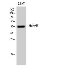 Anti-HoxA5 antibody