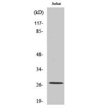 Anti-MaxiKβ2 antibody