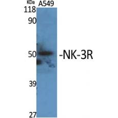 Anti-NK-3R antibody