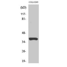 Anti-Olfactory receptor 52B2 antibody